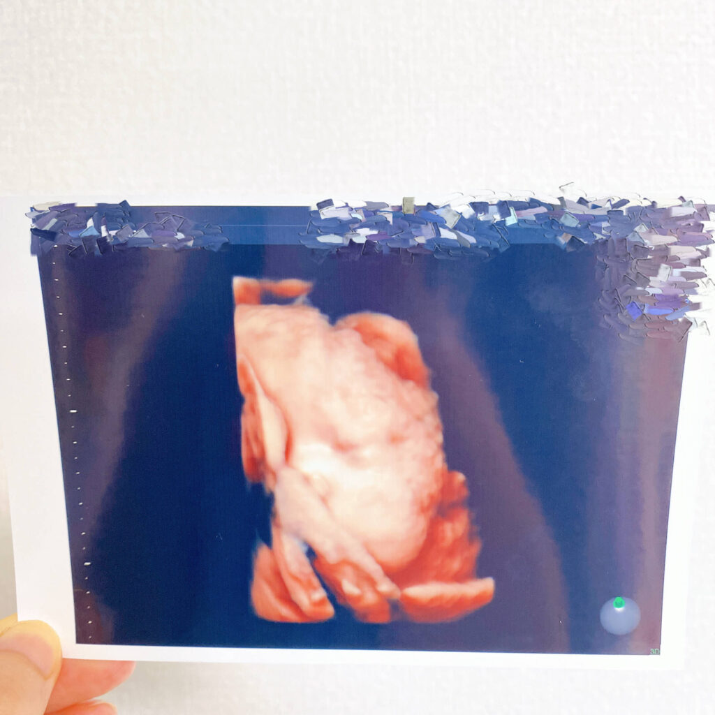 妊娠12週のエコー写真